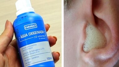 Receita com Água Oxigenada para acabar com rinite, resfriado e sinusite!❤️❤️