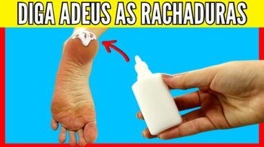 TÔ CHOCADA !! NÃO GASTE MAIS DINHEIRO COM PRODUTOS CAROS - PÉ RACHADO E PELE SECA NUNCA MAIS!