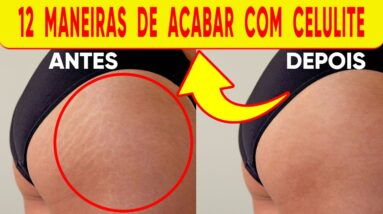 COMO ELIMINAR CELULITE 12 RECEITAS CASEIRAS