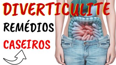 DIVERTICULITE COMO TRATAR DIVERTICULITE COM REMÉDIOS CASEIROS