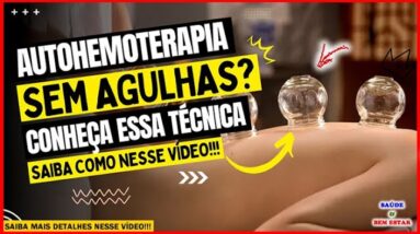 🔴 AUTOHEMOTERAPIA SEM AGULHAS??? Saiba como fazer nesse vídeo!!!