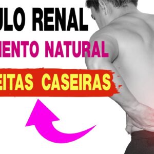 CÁLCULO RENAL 12 MANEIRAS DIFERENTES DE TRATAR CÁLCULOS RENAIS