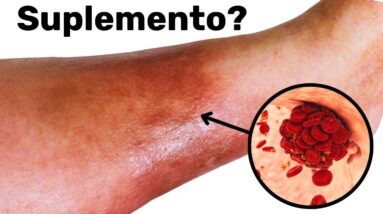 Uma colher de sopa por dia e os coágulos de sangue desaparecem para sempre!