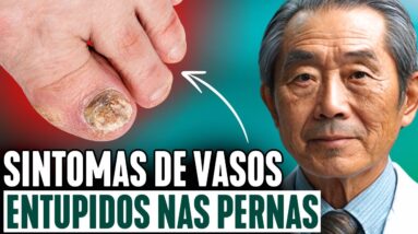 9 SINAIS DE VEIAS ENTUPIDAS NAS PERNAS. Como verificar em casa sem médico?