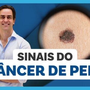 CÂNCER DE PELE: tipos, sinais, tratamento e como prevenir