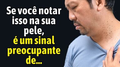 Essa é a VERDADEIRA causa das suas MARCAS DE PELE