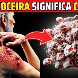 Médicos alertam: Essa COCEIRA pode ser 99% CÂNCER (Sinais Precoces de Câncer em Adultos)