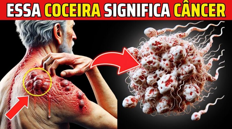 Médicos alertam: Essa COCEIRA pode ser 99% CÂNCER (Sinais Precoces de Câncer em Adultos)