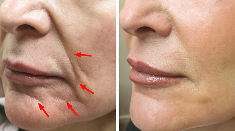 2 Receitas Caseiras Infalíveis para Firmar a Pele e Rejuvenescer o Rosto